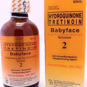RDL Babyface #2