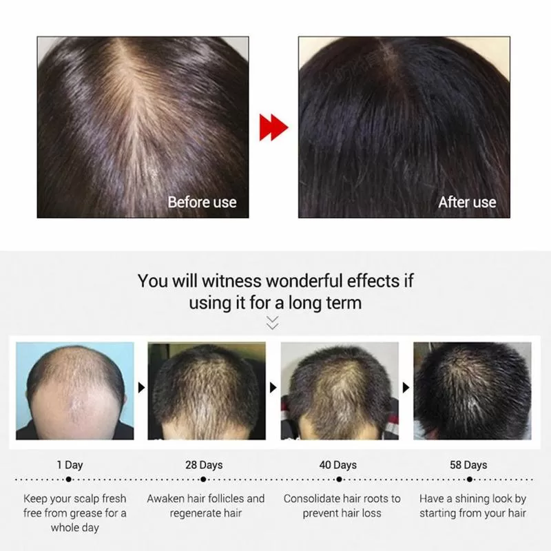 Andrea Hair Growth Essence Oil Hair Loss Treatment - image 2