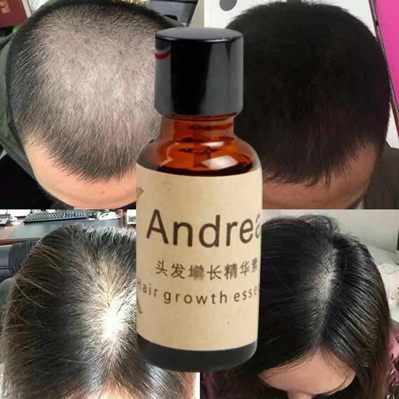Andrea Hair Growth Essence Oil Hair Loss Treatment - image 4