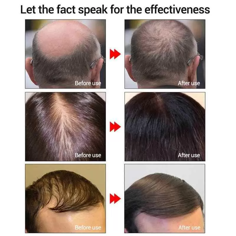 Andrea Hair Growth Essence Oil Hair Loss Treatment - image 5