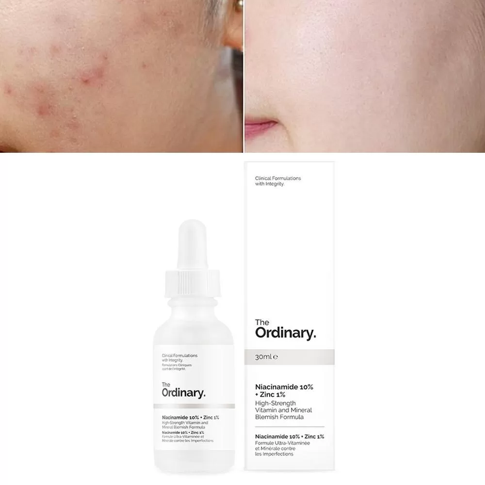 The Ordinary Niacinamide 10% + Zinc 1% Serum Canada - image 2