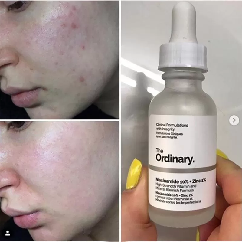 The Ordinary Niacinamide 10% + Zinc 1% Serum Canada - image 3