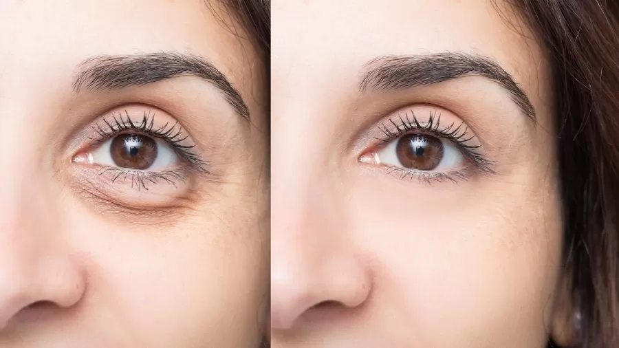 Wokali Eye Cream Anti-Wrinkles Collagen Vitamin E - image 4