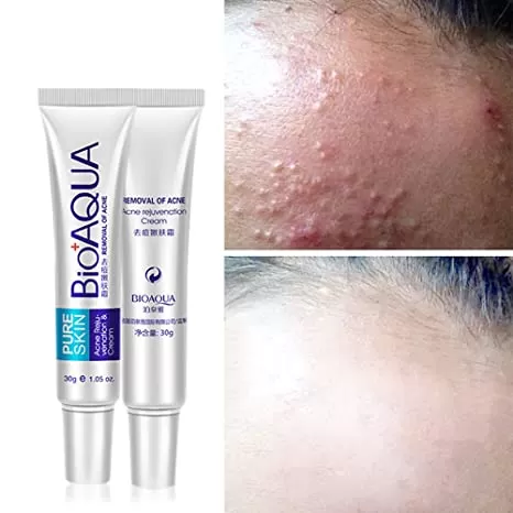 Bioaqua Pure Acne Treatment Scar Removal Cream Dark Spot - image 3