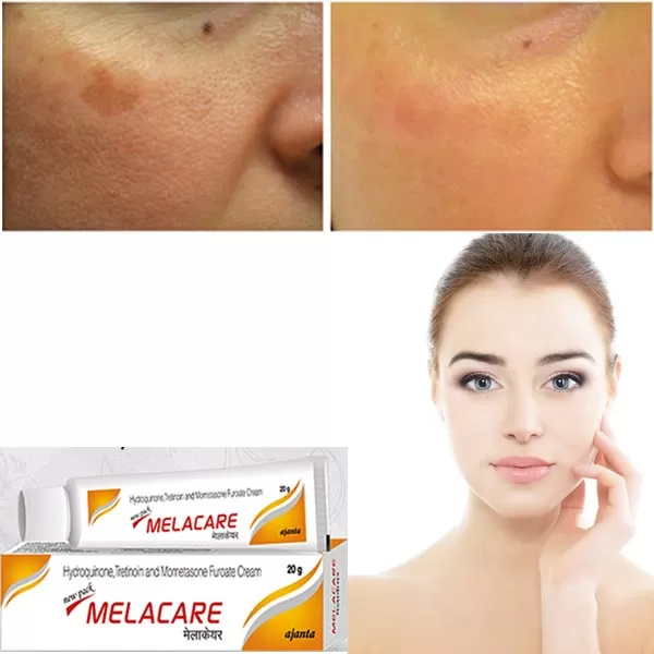 Melacare Hydroquinone  25g Pigmentation Face Cream - image 6