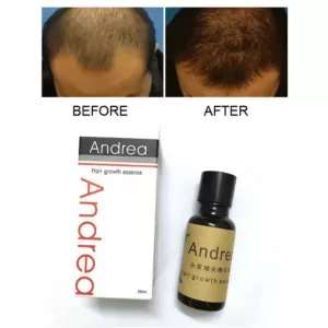 Andrea Hair Growth Essence Oil Hair Loss Treatment