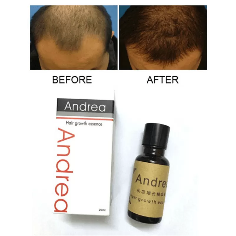 Andrea Hair Growth Oil - image 1