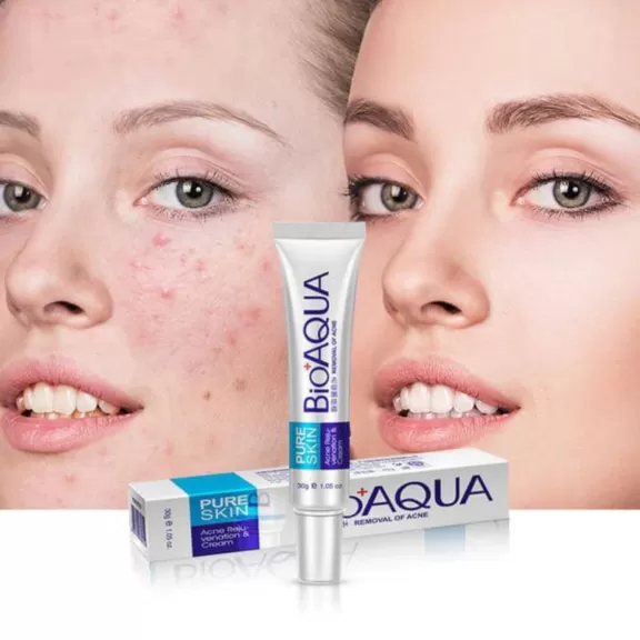 Bioaqua - Pure Skin Acne Cream - image 2