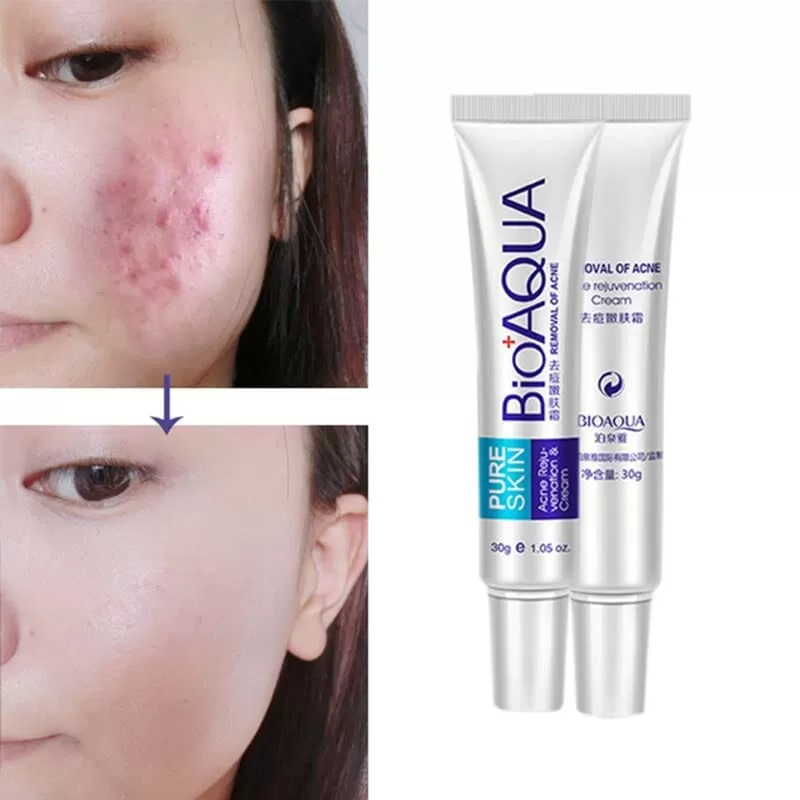 Bioaqua Pure Anti Acne Cream - 30g - image 1