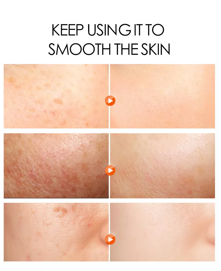 Dr Rashel Fade Spots Night Cream​ Removes Dark Spot 50g - image 3