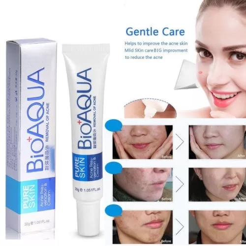 Bioaqua Pure Acne Treatment Scar Removal Cream Dark Spot