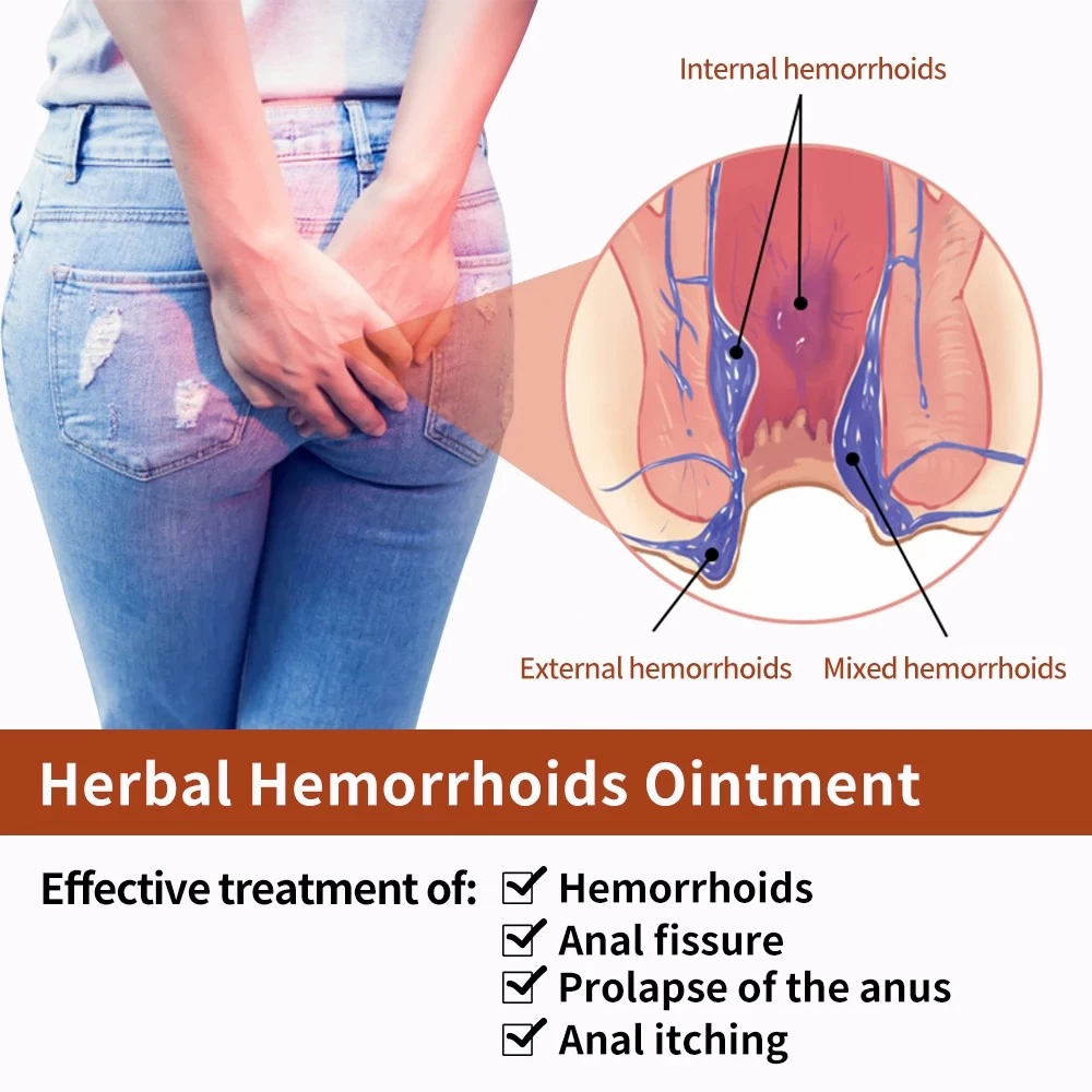 Hua Tuo Hemorrhoids Ointment Plant Herbal Materials - image 6