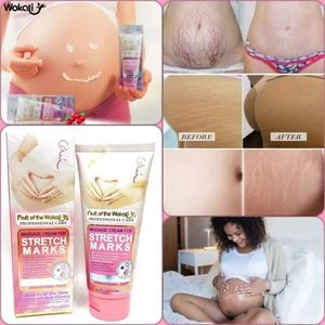 Fruit Of The Wokali Stretch Marks Remover Cream 130ML