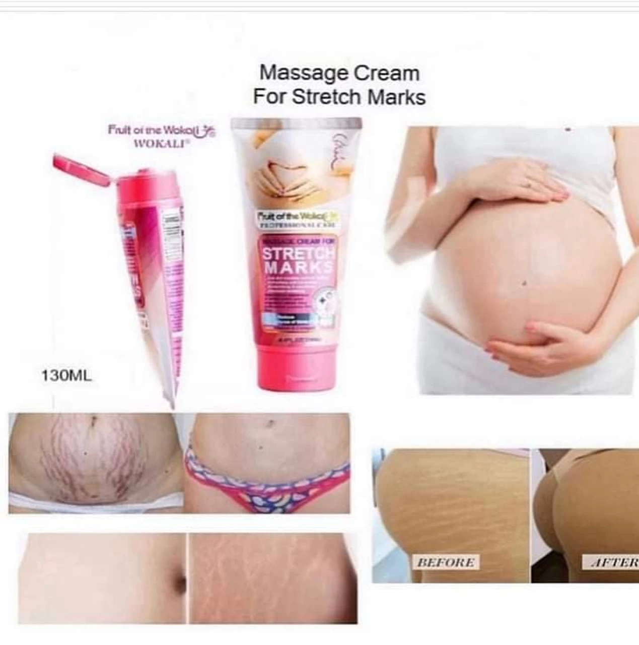 Fruit Of The Wokali Stretch Marks Remover Cream 130ML - image 2