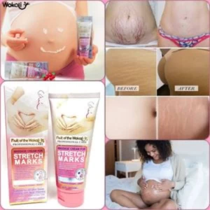 Fruit Of The Wokali Stretch Marks Remover Cream 130ML