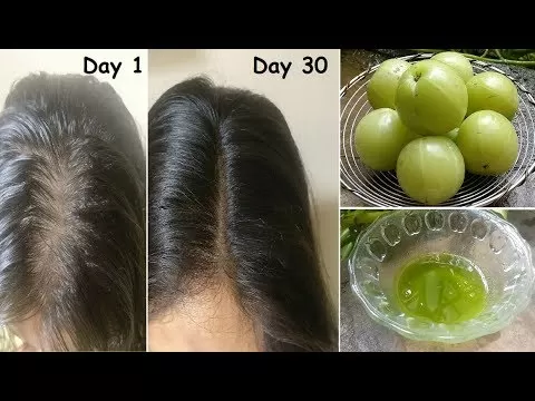 Dabur Amla Hair Oil Long Strong & Dark Hair 300ml - image 2