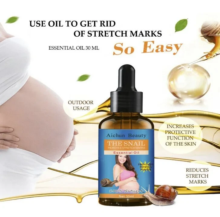 Aichun Beauty Snail Essential Oil Stretch Mark Remover - image 2