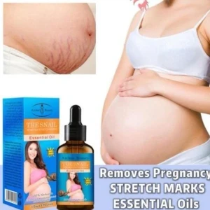 Aichun Beauty Snail Essential Oil Stretch Mark Remover