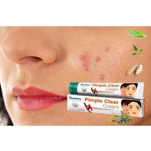 Himalaya Acne-n-Pimple Cream Treats Pimples - image 2