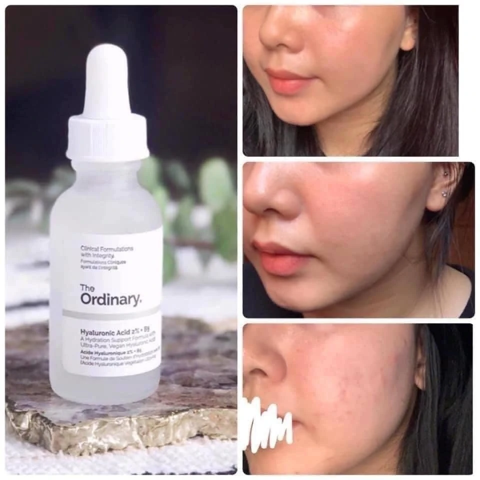 The Ordinary Hyaluronic Acid 2% +B5 Hydrating Serum - image 2