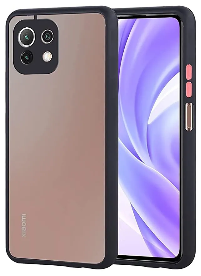 Mi 11 lite Shockproof Camera Guard Jingle Back Cover