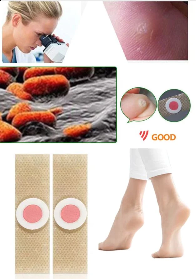 Generic Foot Corn Plaster Patches for Corn Removal - image 7