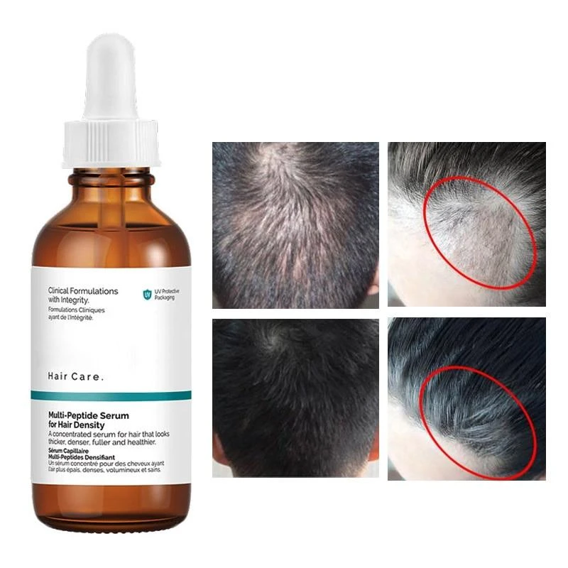 The Ordinary Multi-Peptide Serum for Hair Density 30ml - image 3