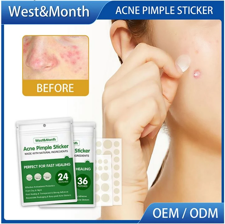 Generic 36PCS Acne Pimple Patch Skin Care - image 3