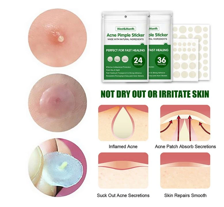 Generic 36PCS Acne Pimple Patch Skin Care - image 4