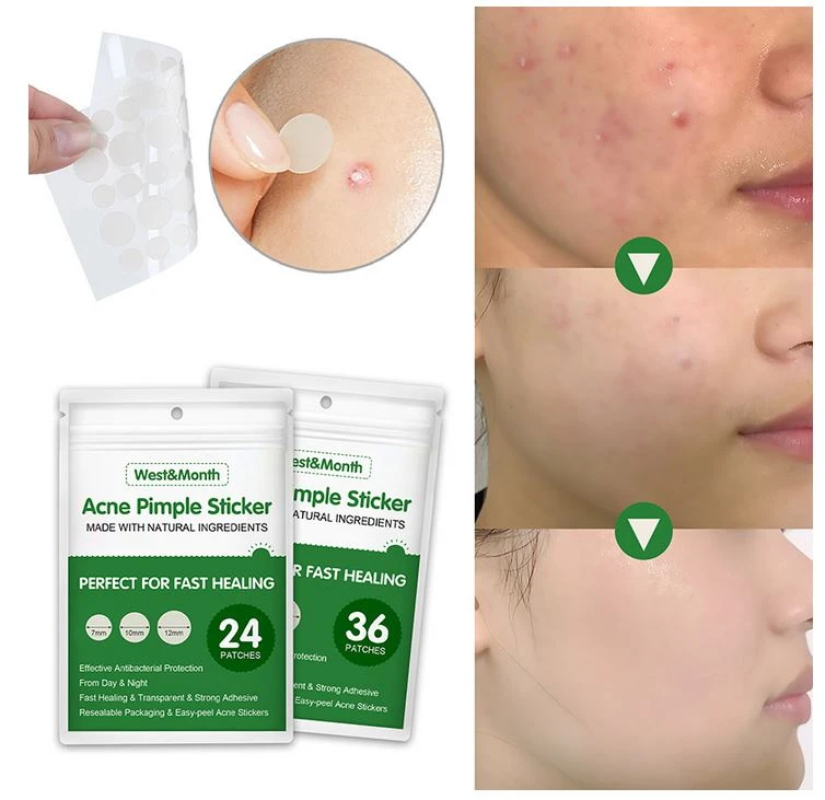Generic 36PCS Acne Pimple Patch Skin Care - image 5