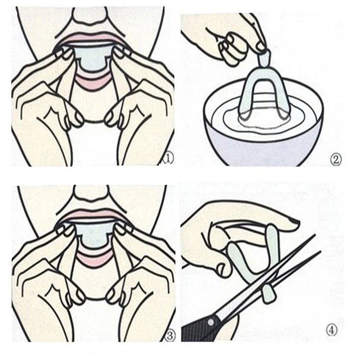 Generic Anti Snoring Bruxism Sleeping Mouth Guard - image 6