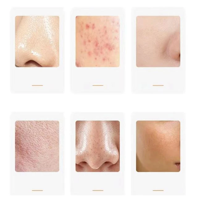 Generic Face Oil Absorbing Roller - image 7