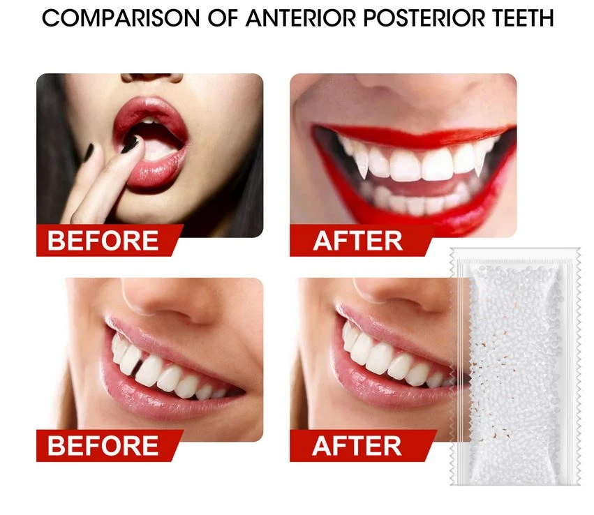 Generic False Teeth Solid Glue Tooth Repair Set - image 5