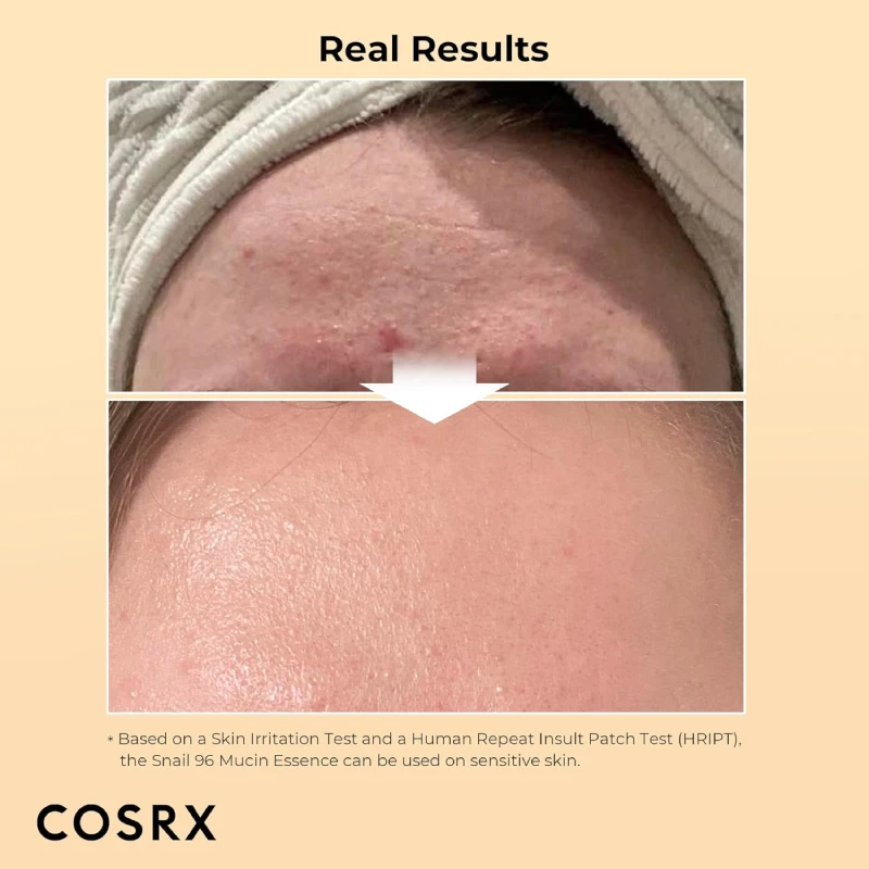 COSRX Advanced Snail 96 Mucin Power Essence 100ml Serum - image 6