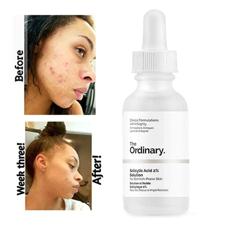 The Ordinary Salicylic Acid 2% Solution Blemish Skin - image 3