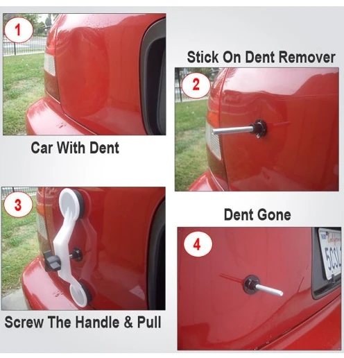 Pops A Dent Car Care Tool Kit Dent Removal System - image 6