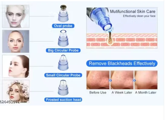 Derma Suction Electric Vacuum Blackhead Remover Kit - image 2