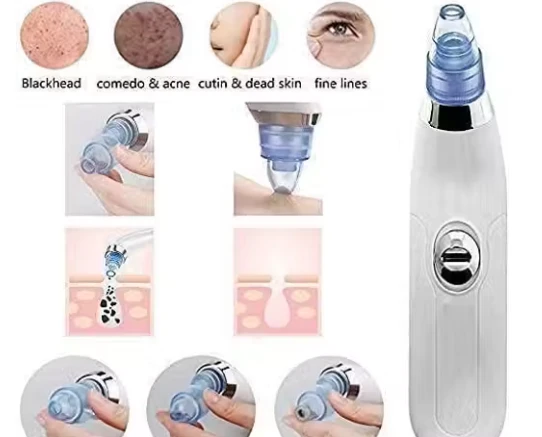 Derma Suction Electric Vacuum Blackhead Remover Kit - image 4