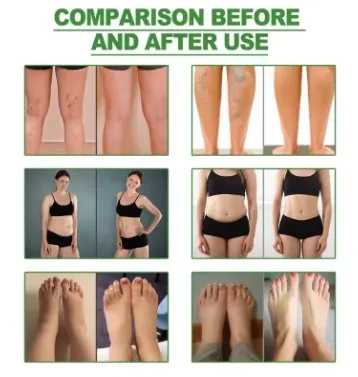 Kinoki Cleansing Detox Foot Pads Stress Relief - image 6